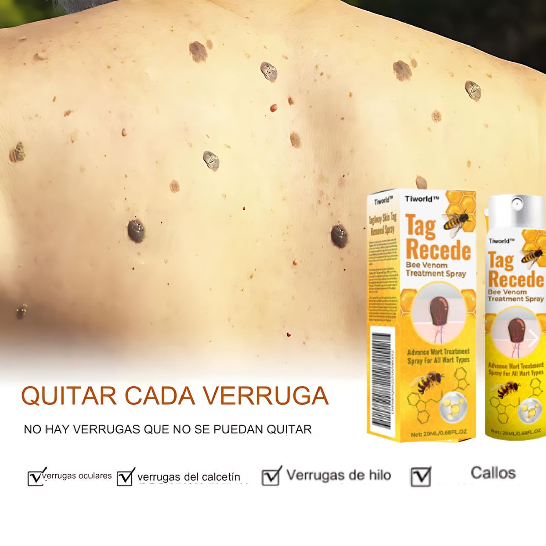 Crema Para Eliminar Verrugas