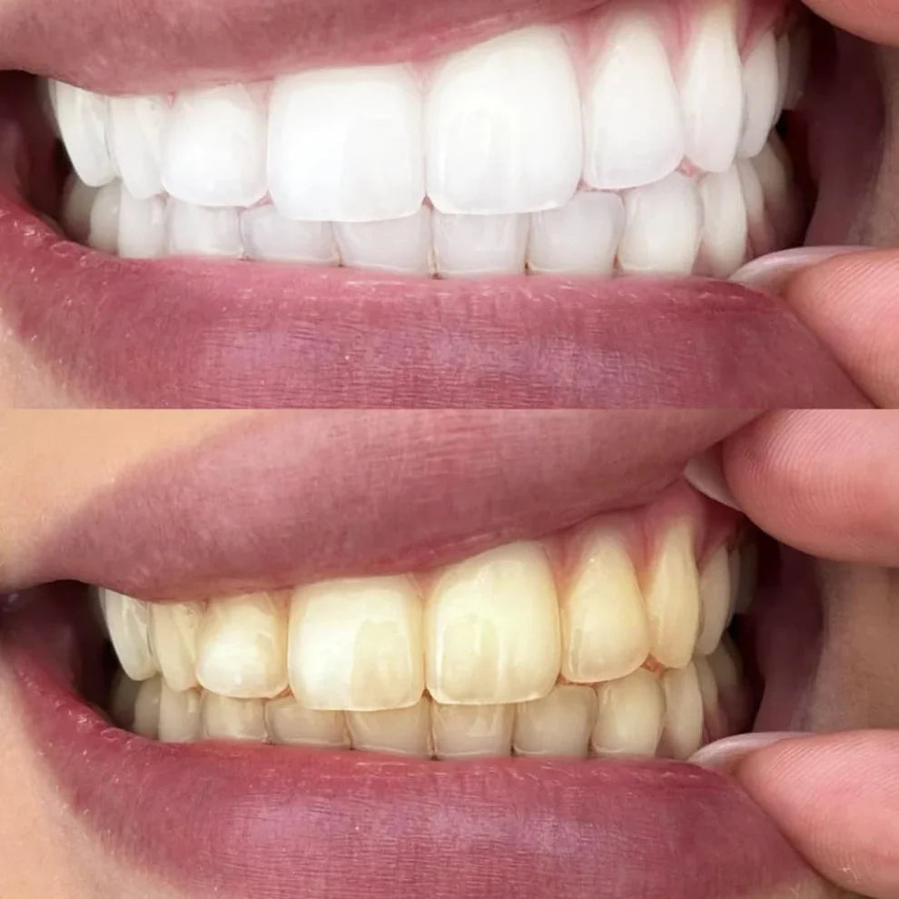 Sonrisa Perfecta