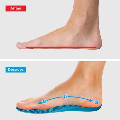 ComfyFeet™: Alivio cómodo y efectivo para tus pies